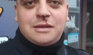 Golpeó y mordió a un efectivo policial