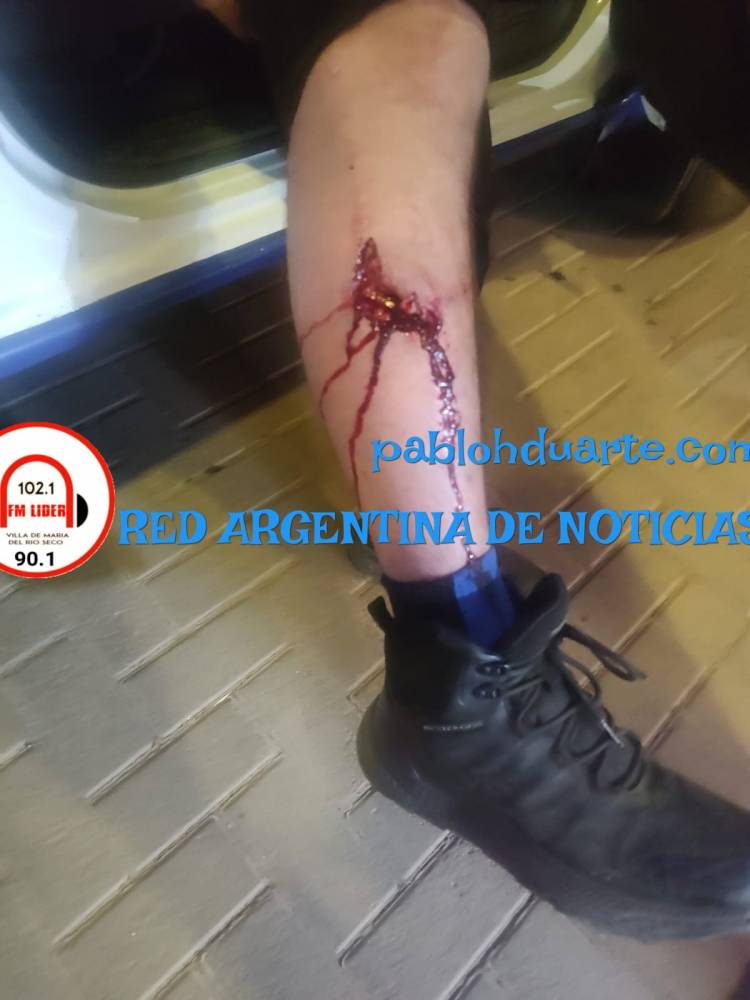 Motociclista atropelló a un policía