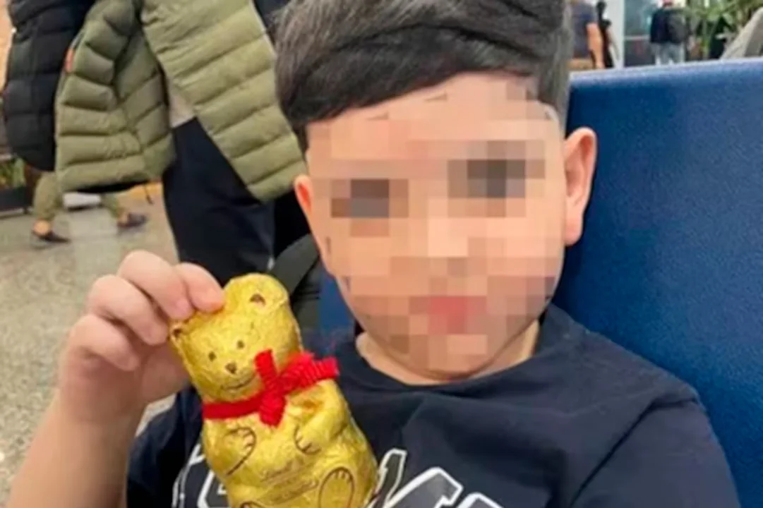 Sufrió lesiones cerebrales y cervicales severas